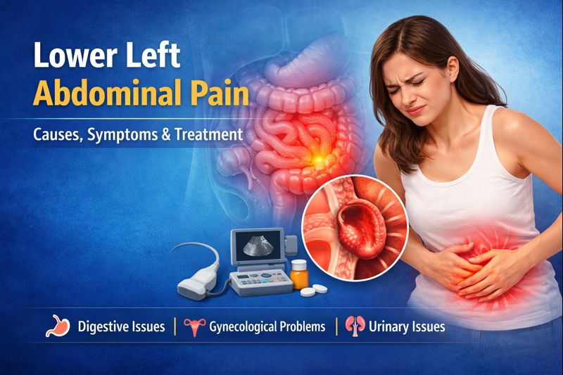 Lower Left Abdominal Pain
