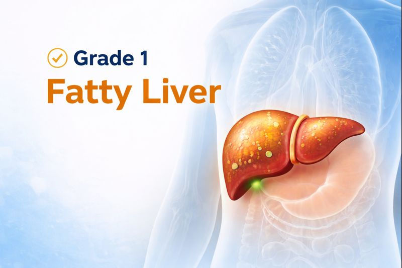 Grade 1 Fatty Liver